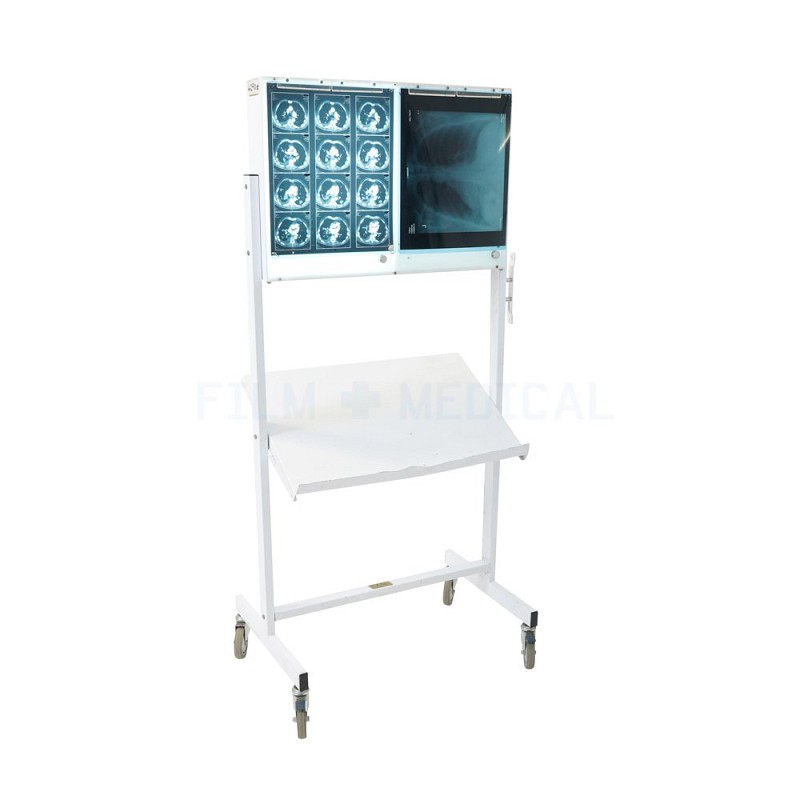 Free Standing Double X-Ray Lightbox